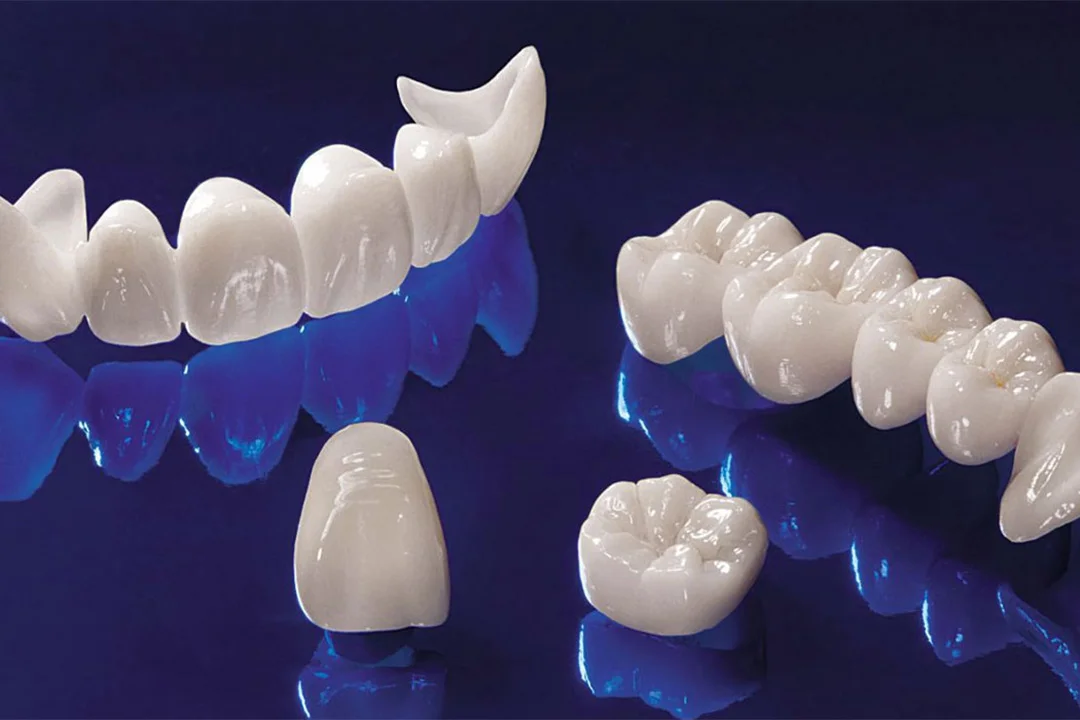 Teeth Colored Crowns